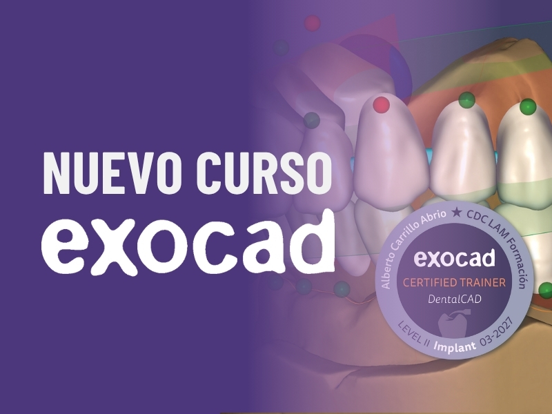 Curso Exomaster Exocad