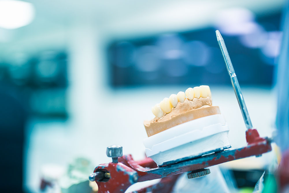 Calidad dental