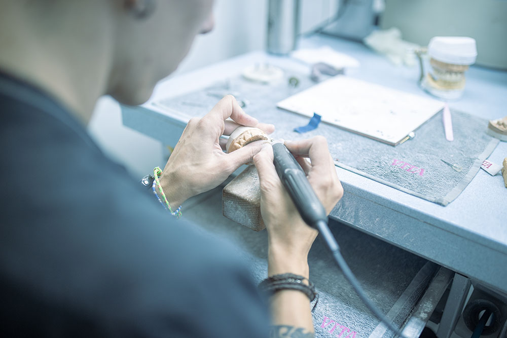 Prótesis sobre implantes