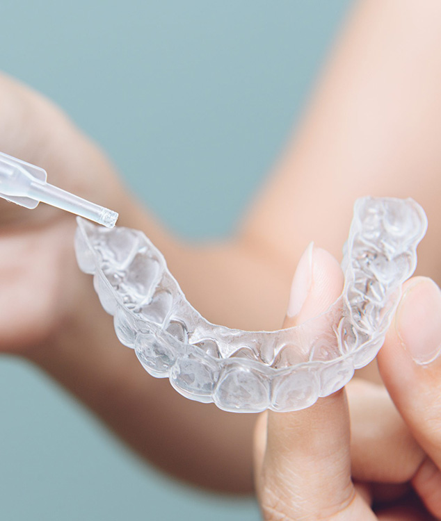 Férulas dentales